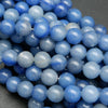 Blue aventurine beads.